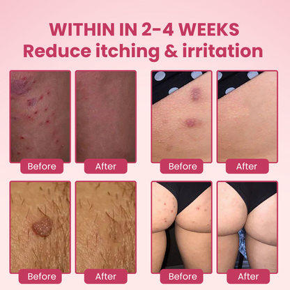 BeeClear MicroDart Patch