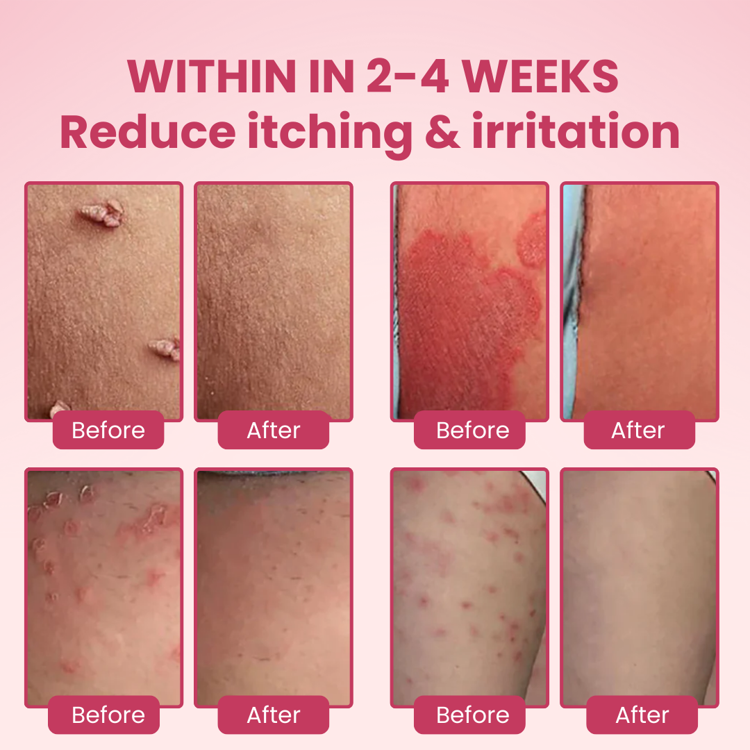 ♀️Lunelle® Woman's Genital Relief Cream 🔥HOT SALE UP TO 60% OFF