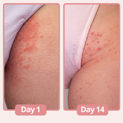 Lunelle® Women's Genital Relief Cream