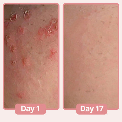 Lunelle® Women's Genital Relief Cream